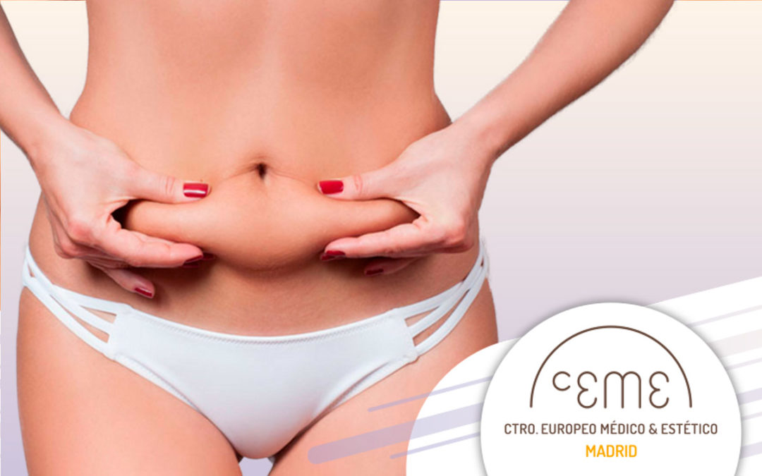 Beneficios de la Abdominoplastia