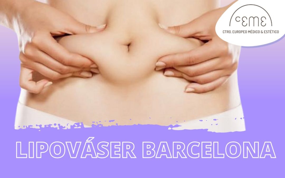 Lipováser en Barcelona