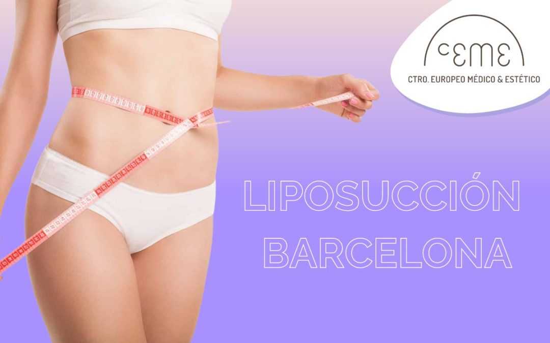 Liposucción en Barcelona