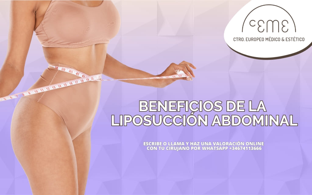 Beneficios de la liposucción abdominal