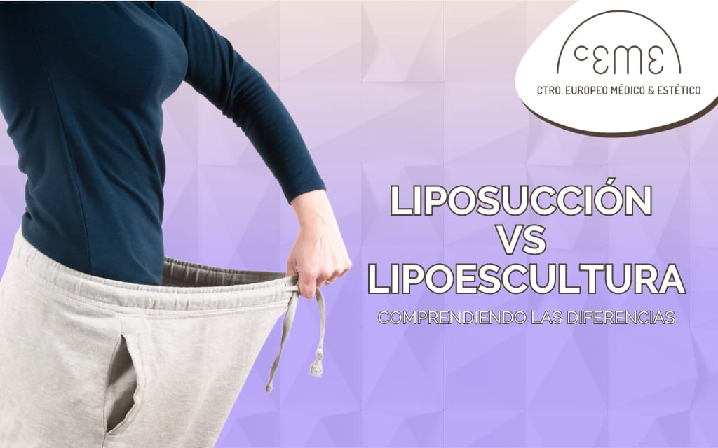 Liposucción vs. Lipoescultura: Comprendiendo las Diferencias