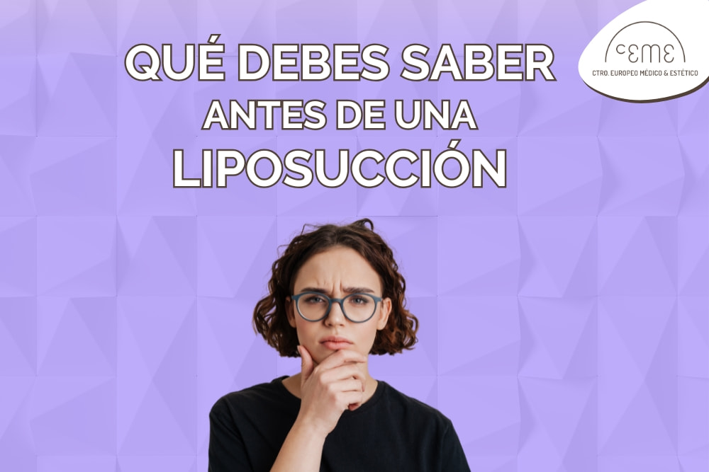 datos a tener en cuenta antes de una Liposucción