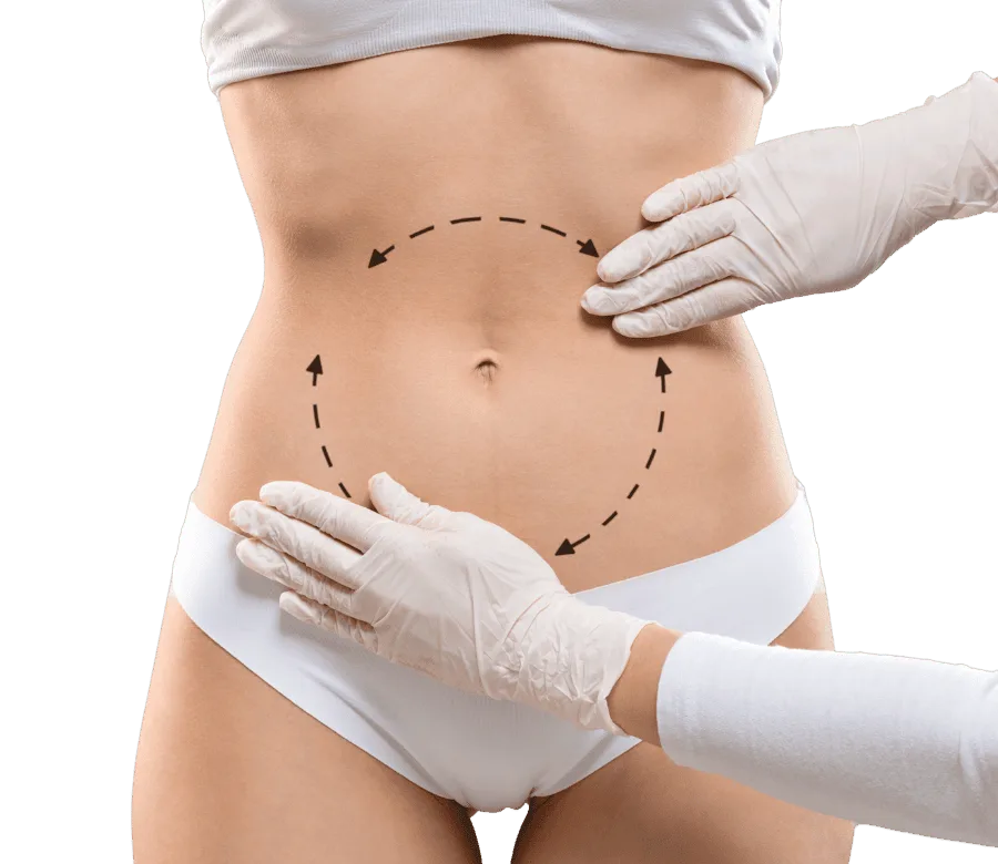 Cirugía corporal abdominoplastia Madrid Ceme