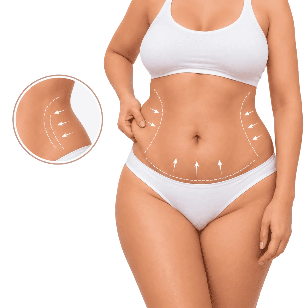 Abdominoplastia para eliminar exceso de piel y mejorar el contorno abdominal