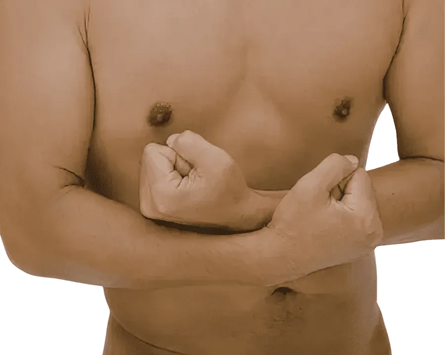 Ginecomastia para eliminar exceso de grasa o tejido glandular y mejorar el contorno del pecho masculino
