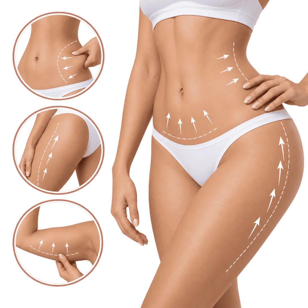 Miniabdominoplastia para eliminar el exceso de piel y la flacidez bajo el ombligo