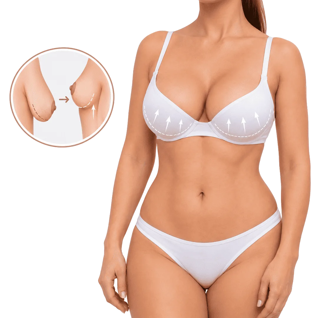 Mastopexia para elevar el pecho y mejorar la forma de las mamas