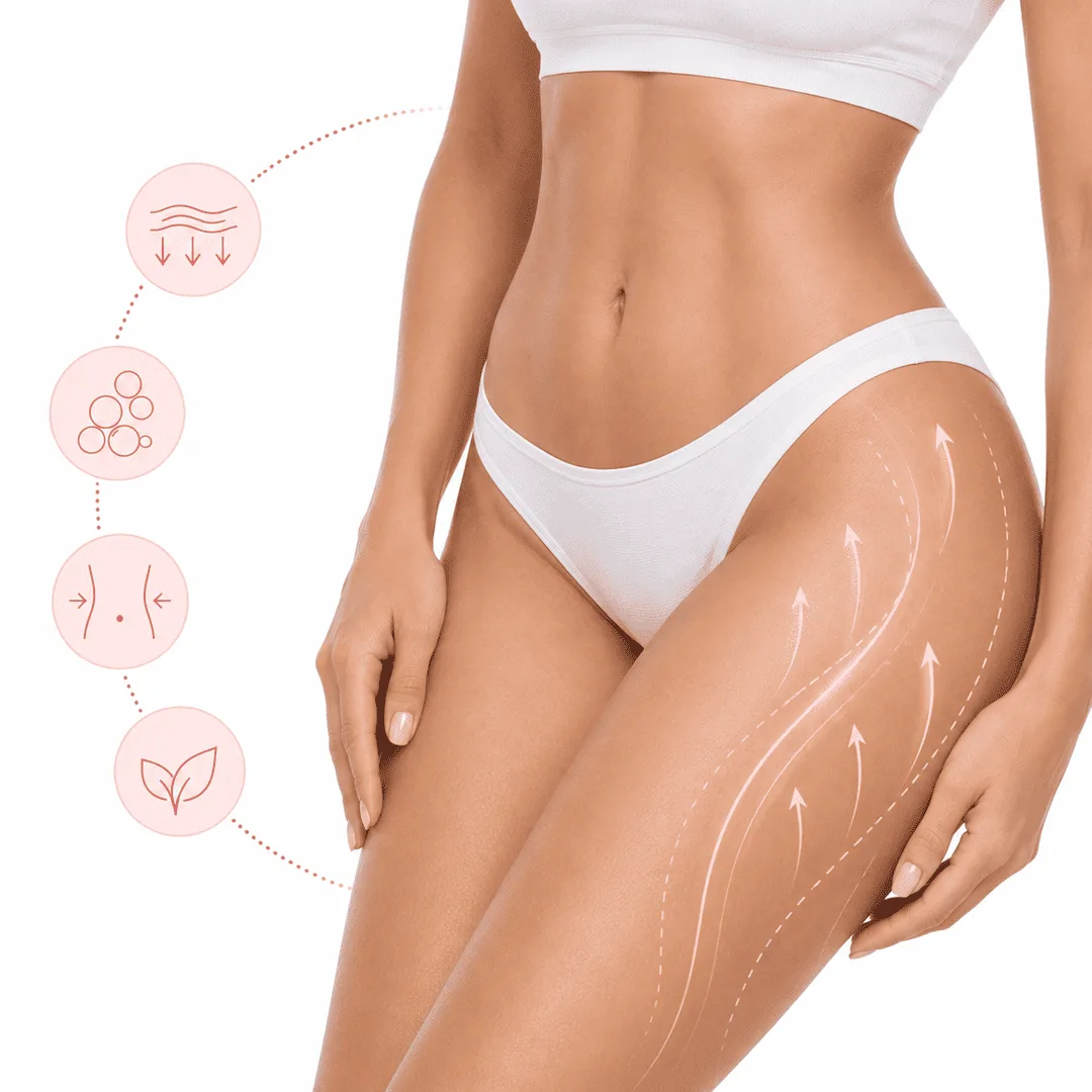 Mesoterapia corporal para mejorar la celulitis y tratar la grasa localizada