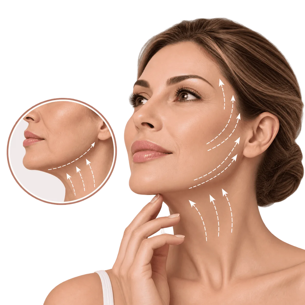 Minilifting facial para mejorar la flacidez y el contorno del rostro