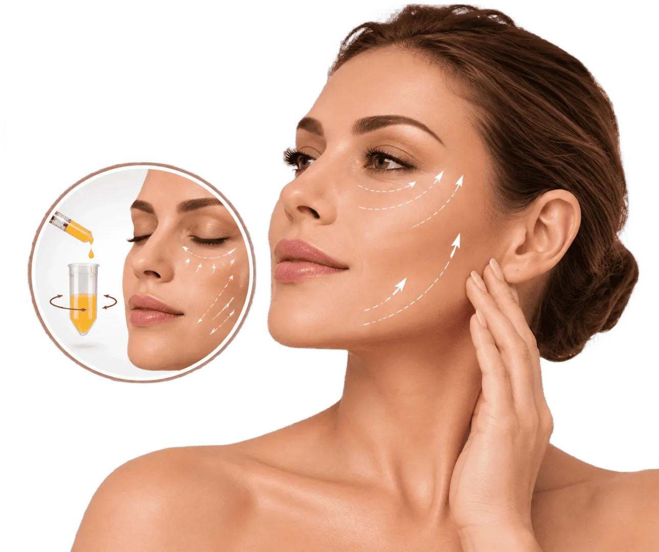 Nanofat con grasa autóloga para mejorar la calidad y rejuvenecer la piel del rostro