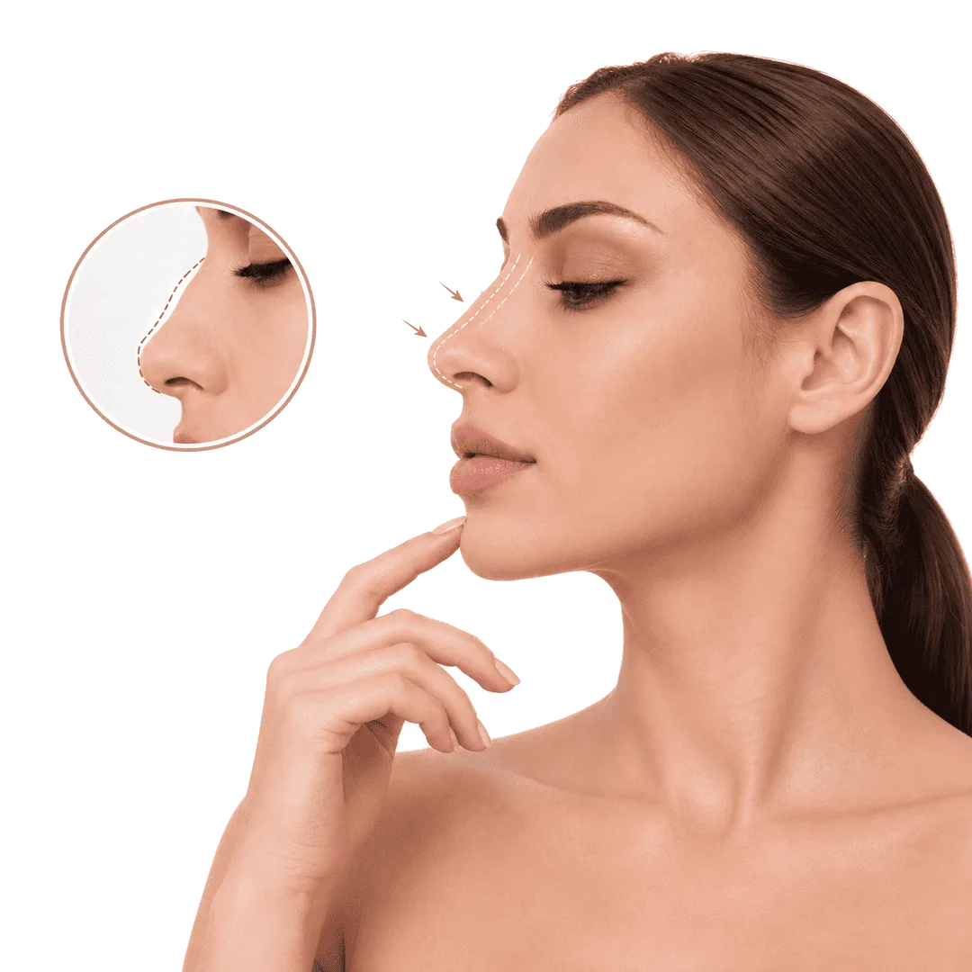 Rinoplastia para mejorar la forma y las proporciones de la nariz